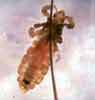 Head Lice